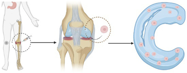 圖1：干細(xì)胞注射方法的過(guò)程示意圖。