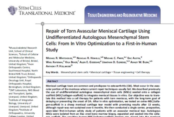 間充質(zhì)干細(xì)胞能夠幫助修復(fù)受損的半月板組織，不用手術(shù)切除受傷部位也能讓膝關(guān)節(jié)功能恢復(fù)正常。