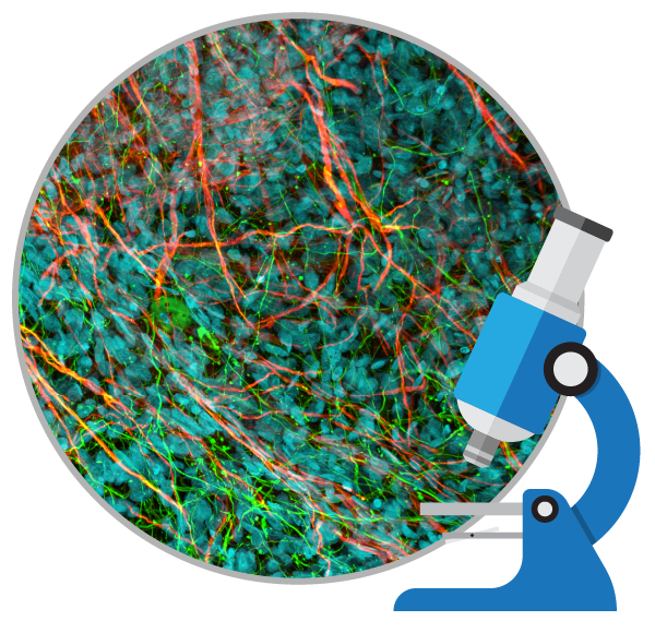 干細胞治療如何對自閉癥患者提供幫助？