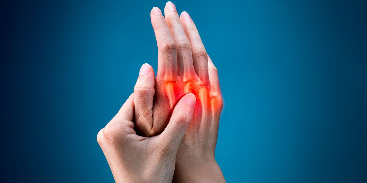 用于治療類風濕性關(guān)節(jié)炎的干細胞 用于治療類風濕性關(guān)節(jié)炎的干細胞