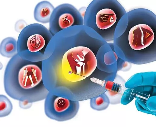 什么是干細胞療法