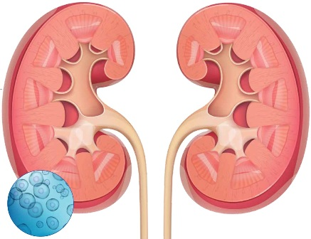 都有哪些干細胞類型應用到腎臟疾病當中？
