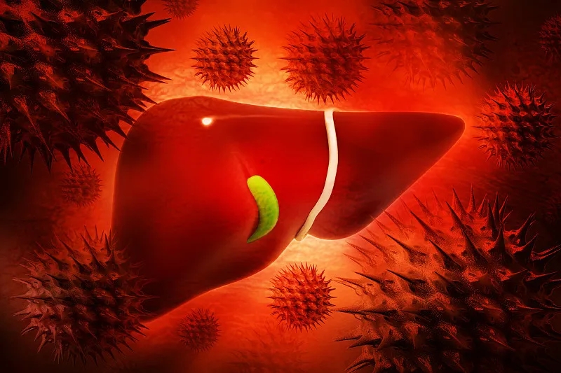 慢性肝病 (CLD) – 原因、癥狀、可用的治療方法