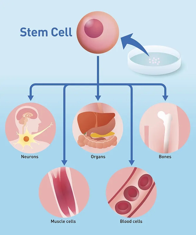 自體干細(xì)胞移植：工作原理、益處和風(fēng)險(xiǎn)