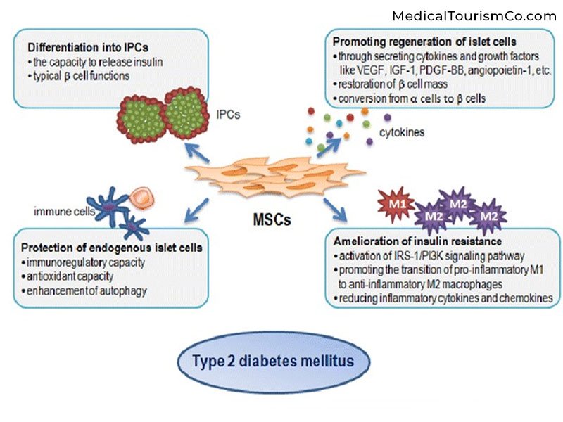 為什么干細(xì)胞治療2型糖尿病？