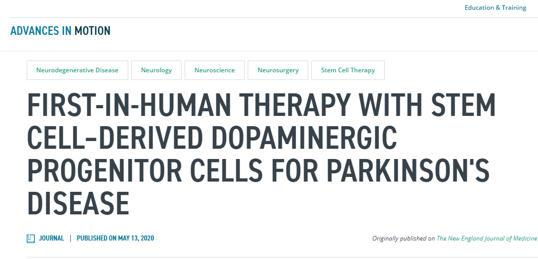首次使用干細胞衍生的多巴胺能祖細胞治療帕金森病的人體療法