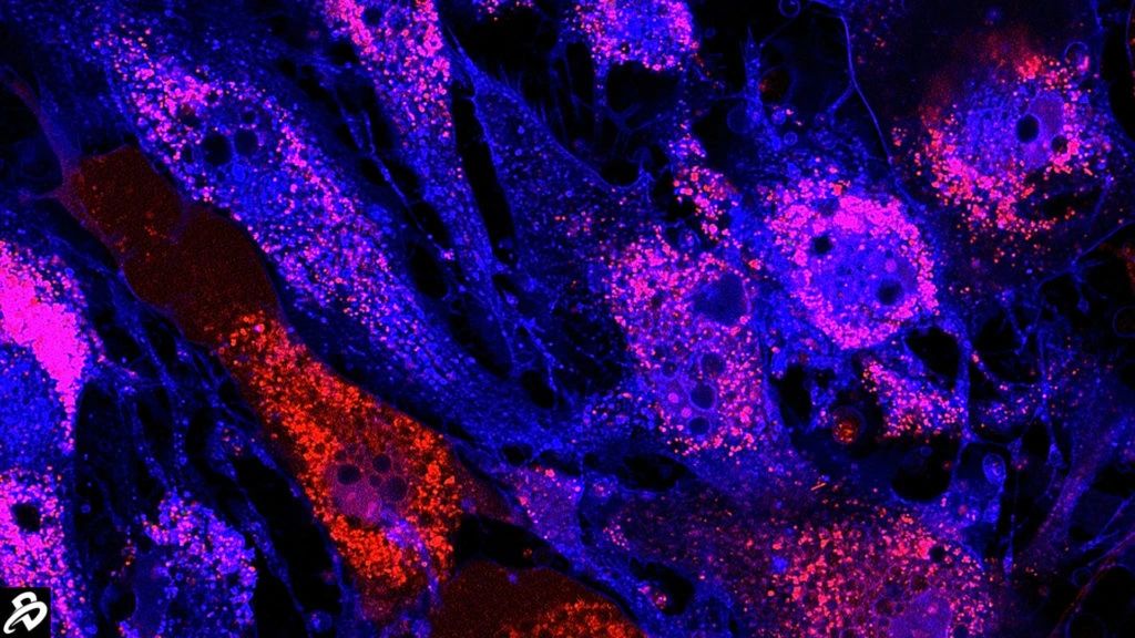 干細胞治療：未來醫學的新星，2030年獲批數量或將突破25款