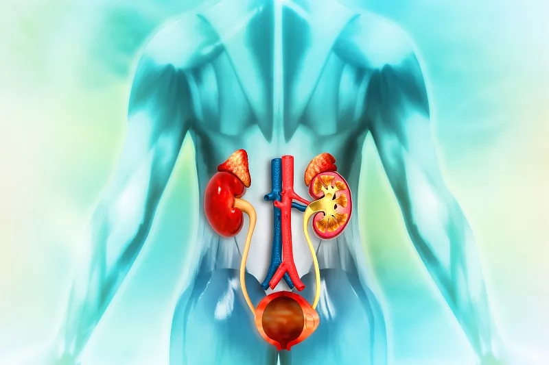 間充質干細胞治療可改善腎衰竭和腎結石多發性發作