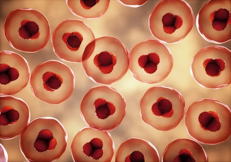 第一位接受Gamida Cell擴展臍帶血細胞療法 Omisirge?治療的患者