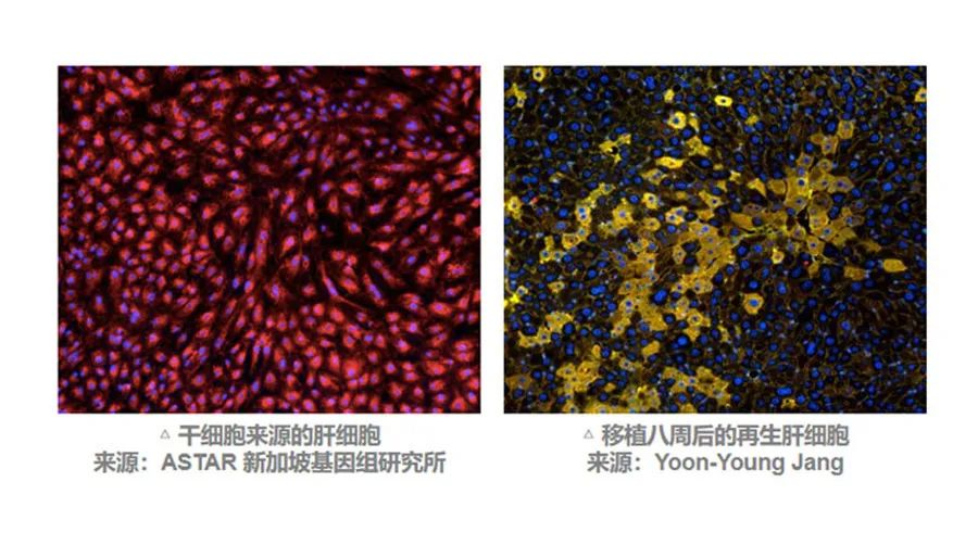 MSC有望通過不同途徑調動肝臟細胞再生來改善預后。