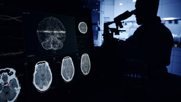神經系統疾病發病機制復雜，涉及基因突變、衰老過程等多種因素。