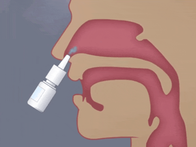 日本居家干細胞噴鼻能治療腦梗死：是科學突破還是商業(yè)噱頭？