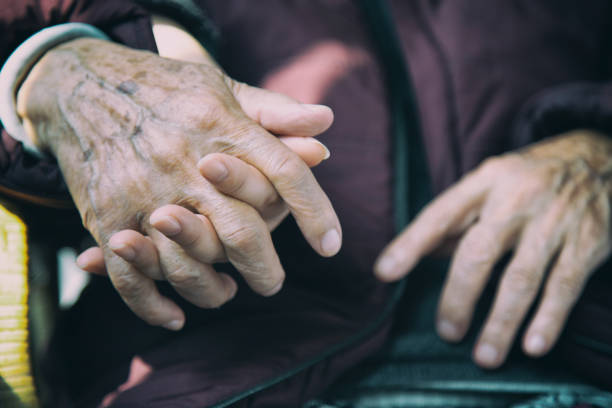 拜爾旗下子公司針對帕金森病的I期臨床試驗在18個月時繼續顯示積極趨勢