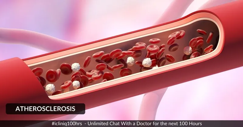 動脈粥樣硬化的體征和癥狀是什么？治療方案有哪些？