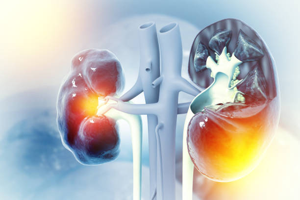 內源性急性腎損傷治療