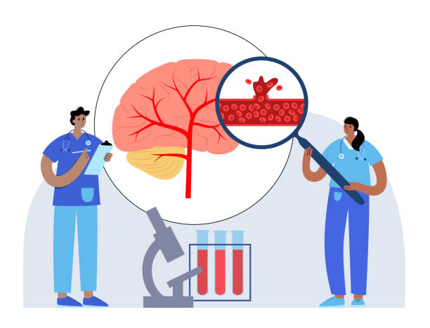 圍產期中風-類型、原因和風險因素