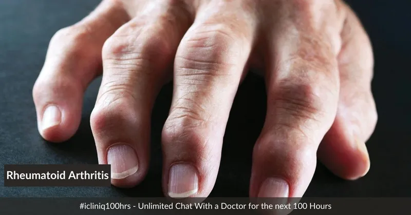 類風(fēng)濕關(guān)節(jié)炎的體征和癥狀是什么？及其治療方法