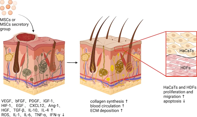 圖5：間充質干細胞促進皮膚創面愈合的機制。