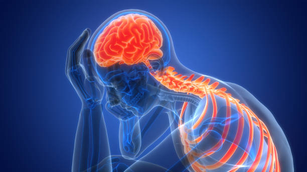 什么是缺血性腦中風，癥狀、原因、診斷和治療