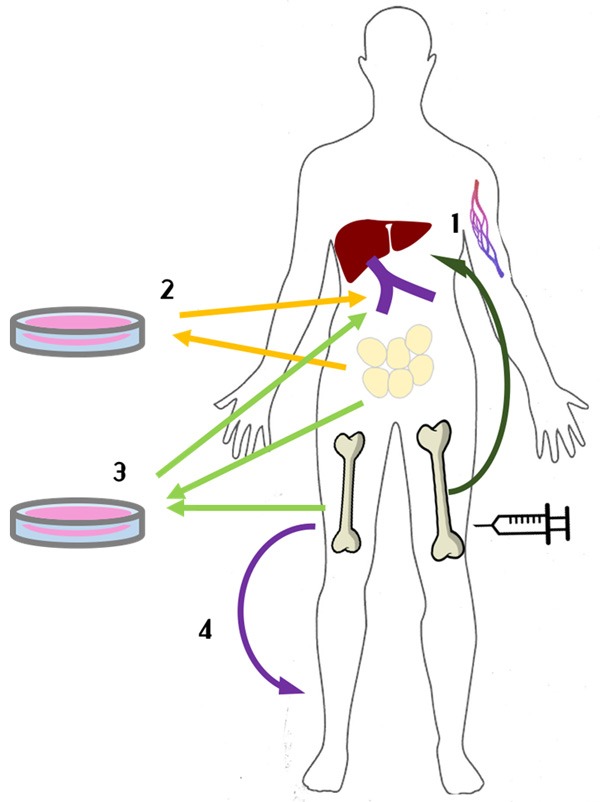 圖1：間充質干細胞治療1型糖尿病方法示意圖。