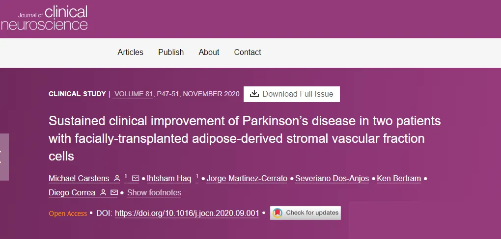 面部移植脂肪來源的基質(zhì)血管成分細胞后，兩名帕金森病患者病情持續(xù)改善