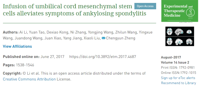 輸注臍帶間充質干細胞可緩解強直性脊柱炎癥狀