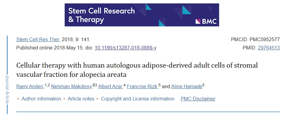 使用人類自體脂肪基質血管成分成體細胞治療斑禿的臨床研究綜述
