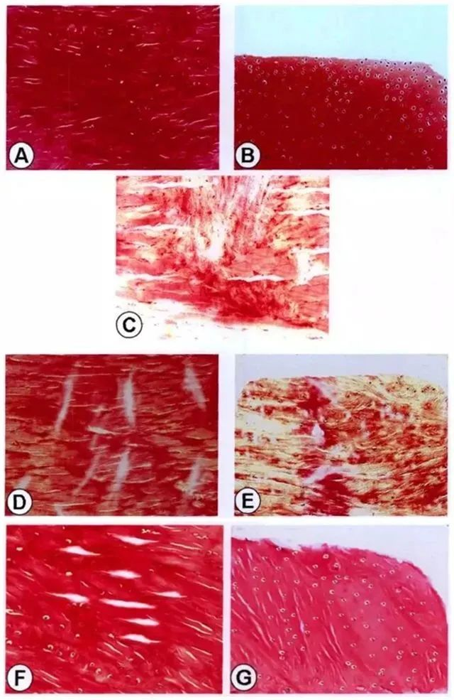 不同時間點修復組織紅-紅區與白-白區II型膠原表達量
