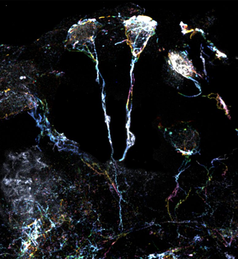 果蠅大腦中處于休眠狀態(tài)的神經(jīng)干細(xì)胞具有富含肌動(dòng)蛋白絲的突起