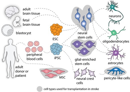 圖2:中風(fēng)后細(xì)胞治療的細(xì)胞類(lèi)型。 圖2:中風(fēng)后細(xì)胞治療的細(xì)胞類(lèi)型。