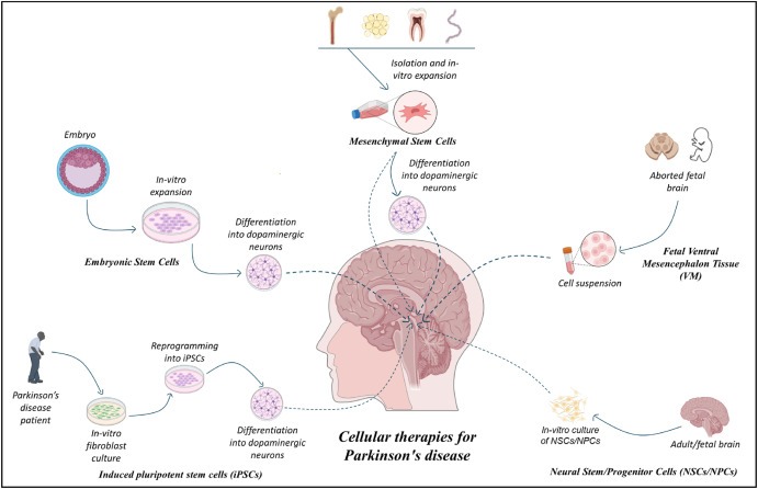 圖1：帕金森病的細(xì)胞療法：胚胎干細(xì)胞 (ESC)、誘導(dǎo)性多能干細(xì)胞 (iPSC)、間充質(zhì)干細(xì)胞 (MSC)、神經(jīng)干細(xì)胞/祖細(xì)胞 (NSC/NPS) 是帕金森病的新興候選藥物。