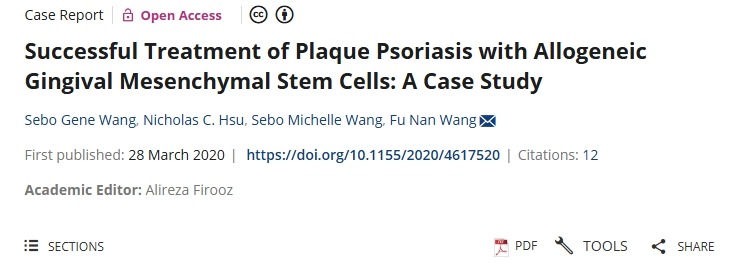 用同種異體牙齦間充質(zhì)干細(xì)胞成功治療斑塊狀銀屑?。喊咐芯? class=