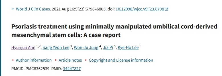 使用微操作臍帶來源的間充質(zhì)干細(xì)胞治療銀屑病：病例報(bào)告