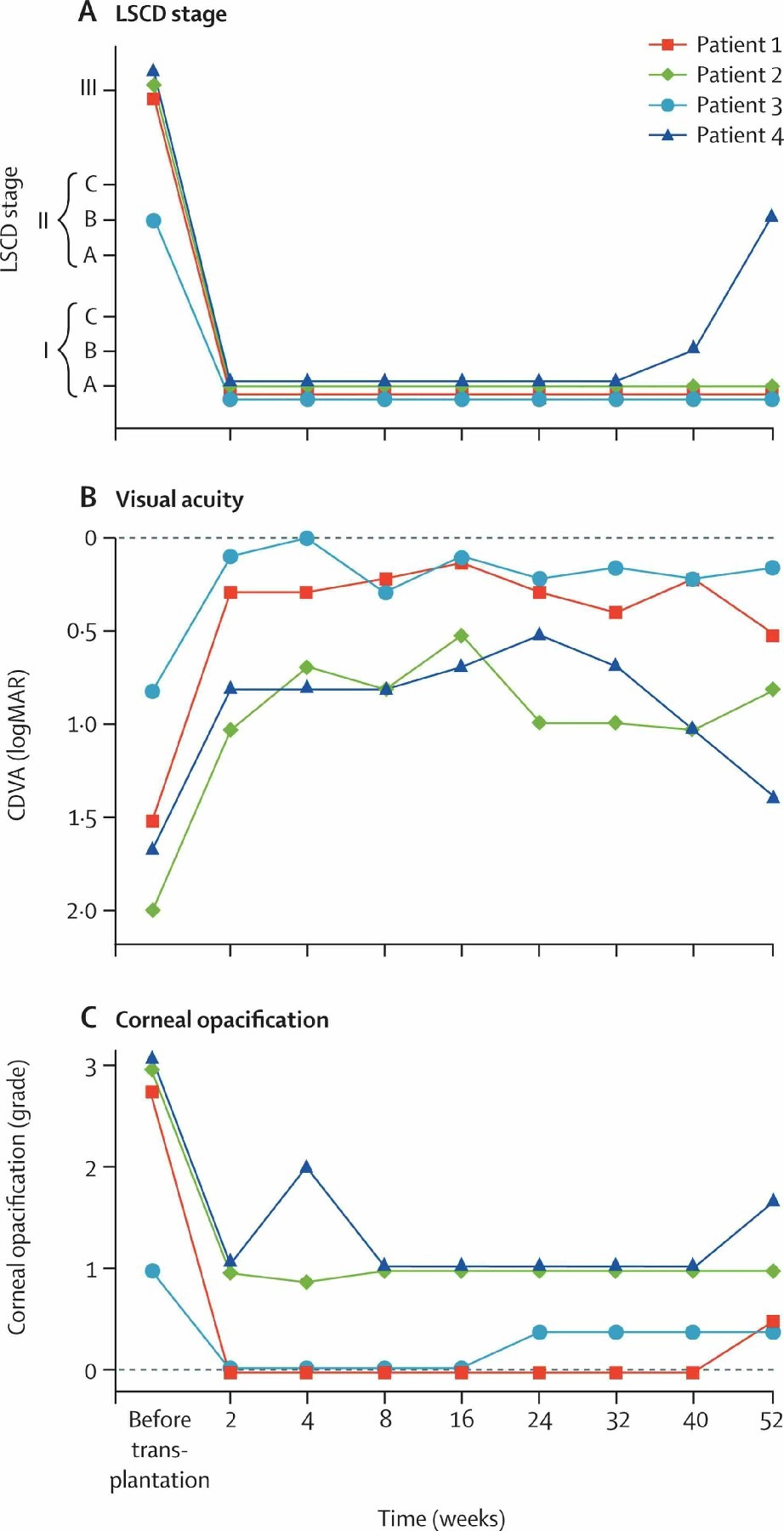 圖2：LSCD 分期、視力和角膜混濁