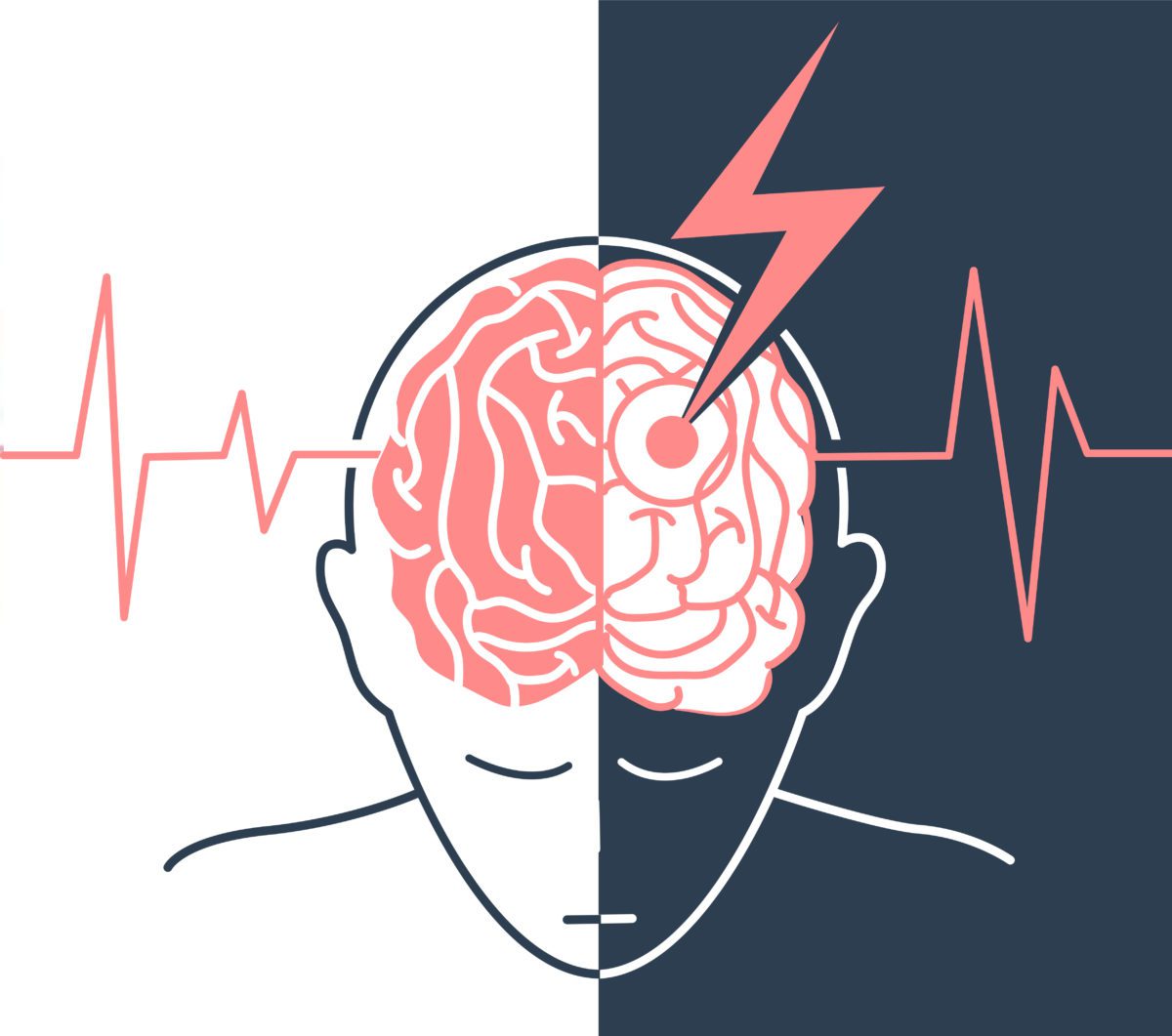 宣武醫院發布：間充質干細胞治療中風，可以改善患者神經功能障礙