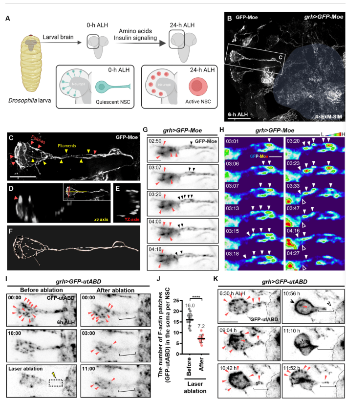 圖2：靜息態神經干細胞再激活過程中的F-肌動蛋白結構和動力學