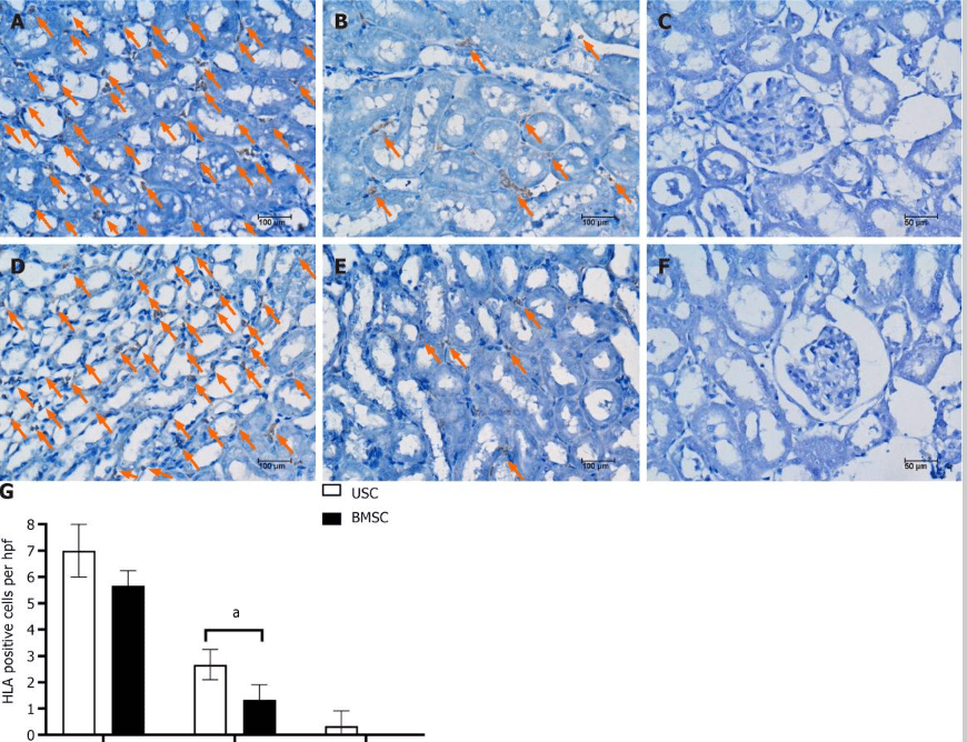 圖5：通過人類白細胞抗原免疫染色檢測急性腎損傷小鼠腎臟內的尿液干細胞或骨髓間充質干細胞