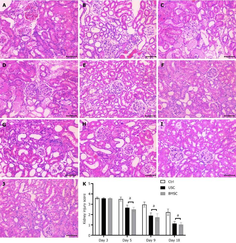 圖4：通過蘇木精和伊紅染色（200 ×）對尿液來源的干細胞治療、骨髓間充質干細胞治療和對照未治療小鼠的急性腎損傷進行組織學檢查。