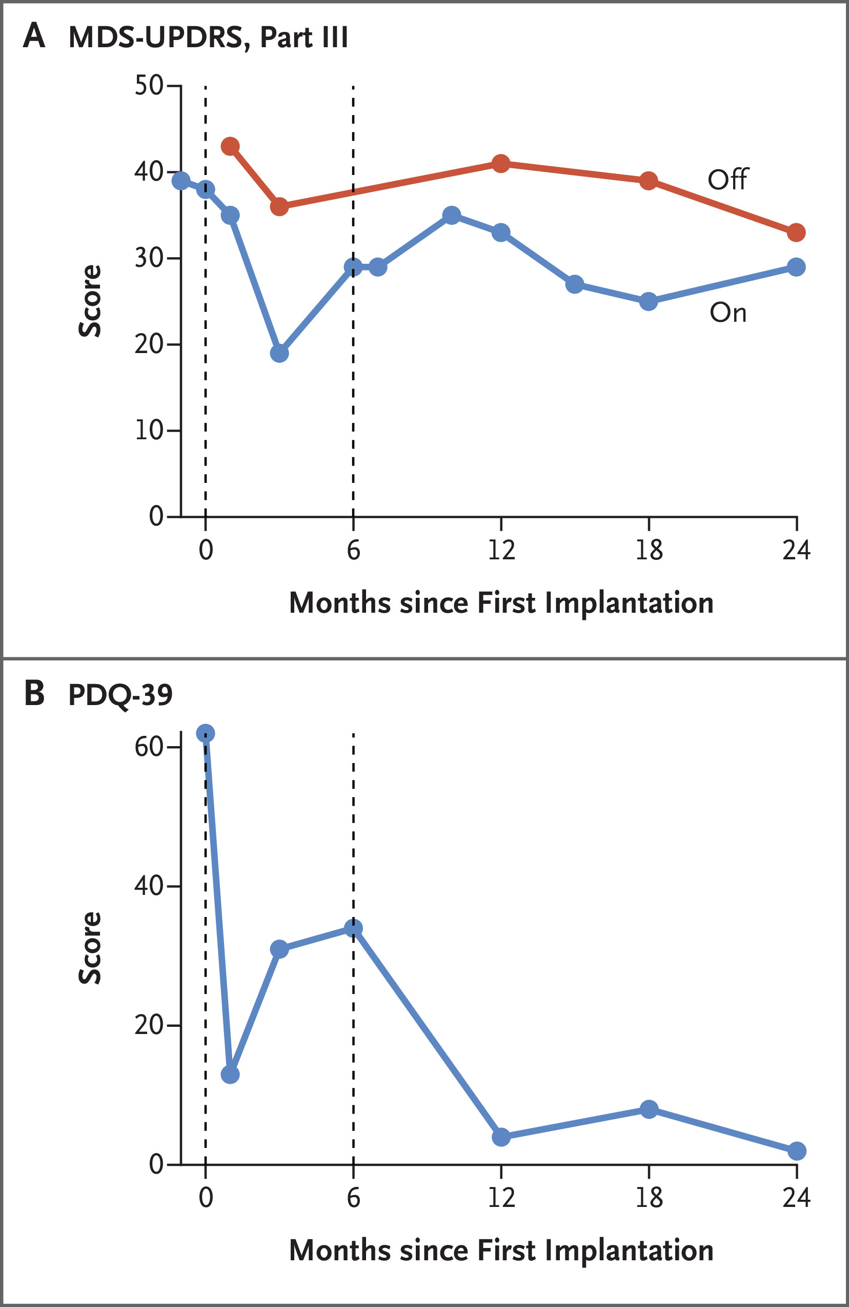 帕金森病相關運動功能和生活質量的縱向臨床評估