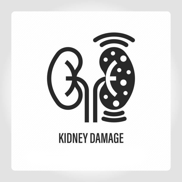 干細(xì)胞療法：扭轉(zhuǎn)腎病患者癥狀的關(guān)鍵力量