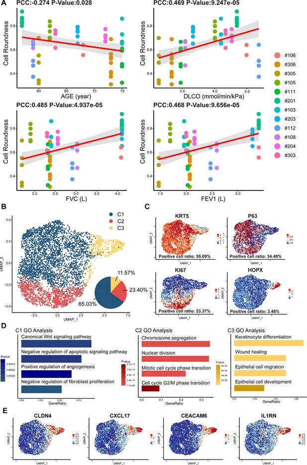 圖2：從IPF患者中分離的P63+肺祖細(xì)胞的細(xì)胞形態(tài)和單細(xì)胞RNA測序分析。