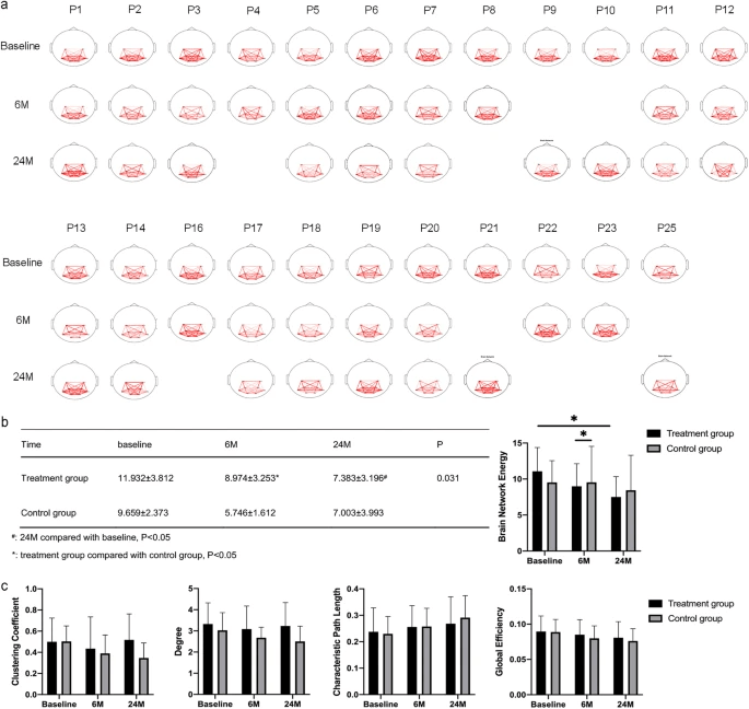 腦功能網絡分析