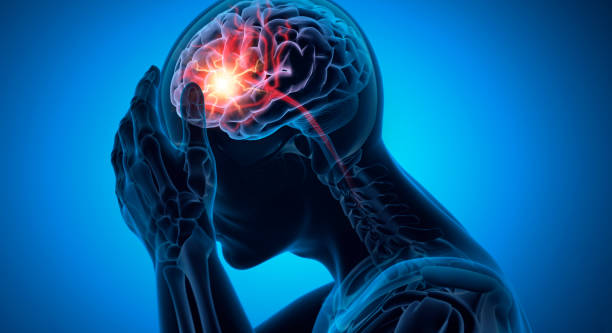 神經(jīng)干細(xì)胞移植：成為治療早期缺血性中風(fēng)時(shí)間窗困境的關(guān)鍵策略