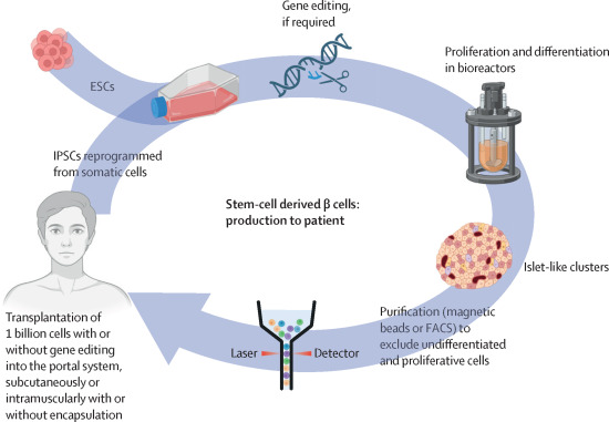 胚胎干細(xì)胞或誘導(dǎo)多能干細(xì)胞來(lái)源的β細(xì)胞的制備和移植