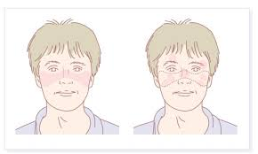 2025年1-12月干細胞治療系統性紅斑狼瘡匯總:多項臨床試驗全面提速! 2025年1-12月干細胞治療系統性紅斑狼瘡匯總:多項臨床試驗全面提速!