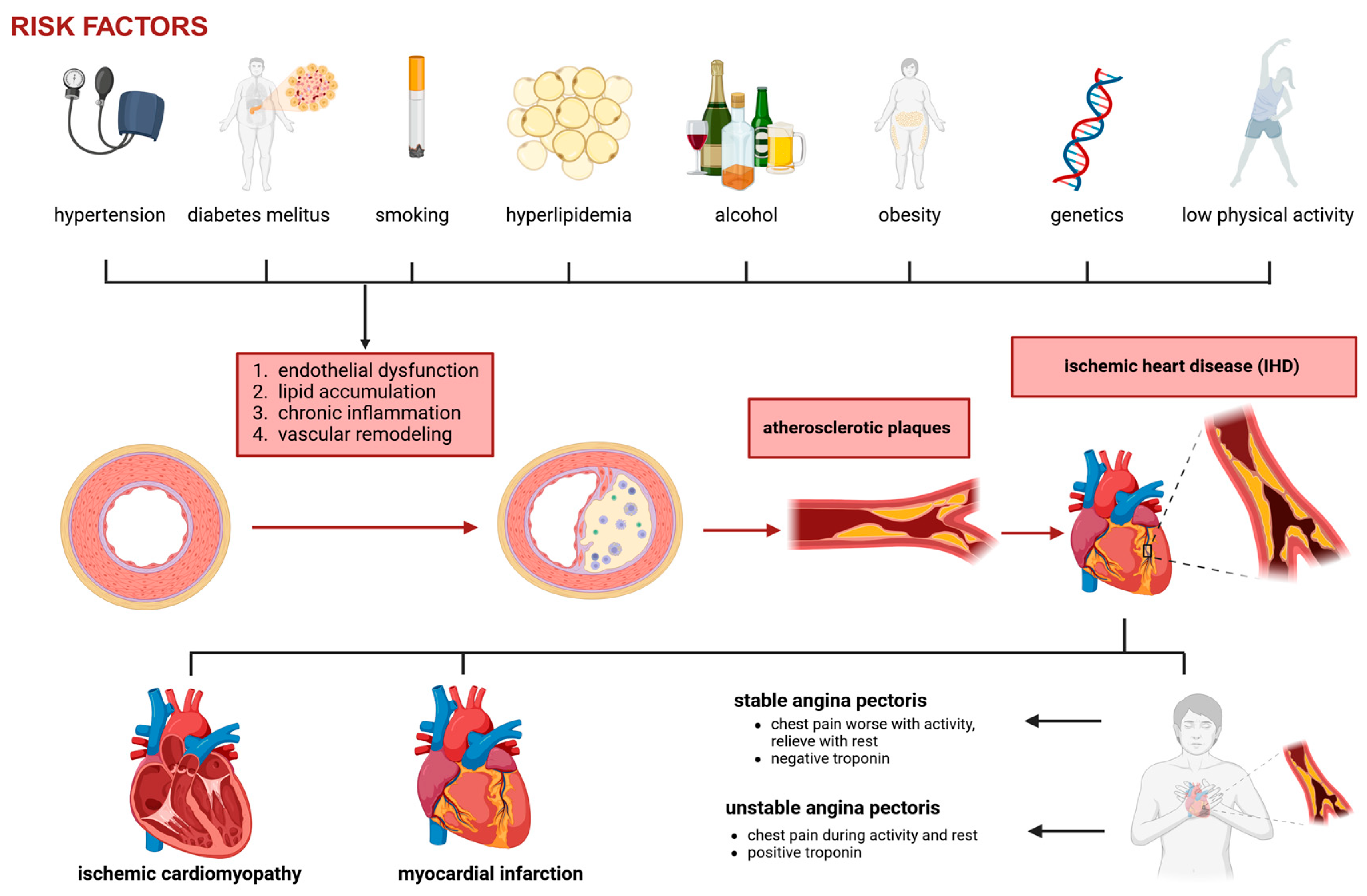 圖1：冠狀動脈疾病和缺血性心臟病的病理生理學。