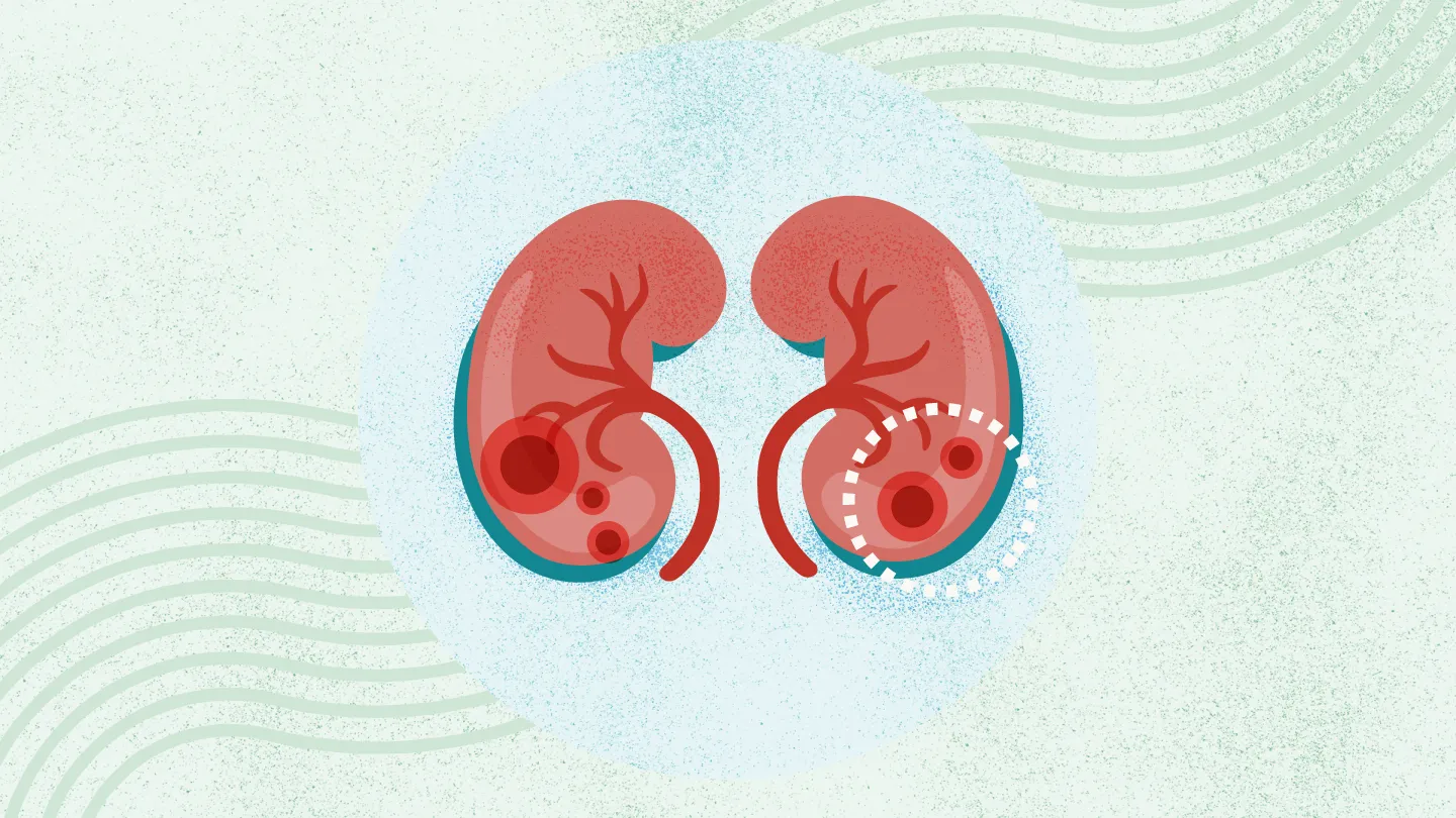 2025年國內干細胞治療腎病的醫院都有哪幾家？