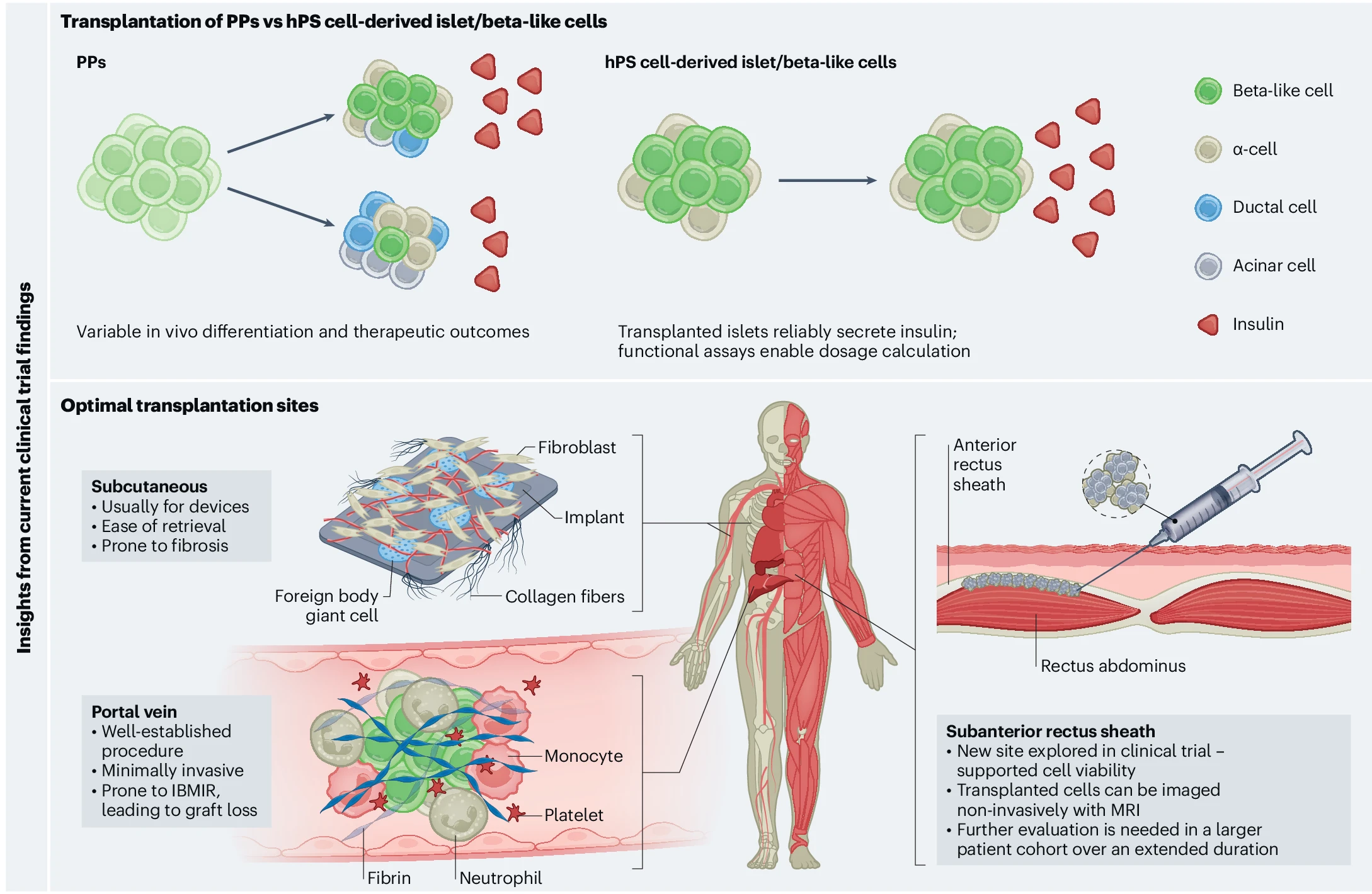 圖2：最新干細(xì)胞治療糖尿病的創(chuàng)新和經(jīng)驗(yàn)教訓(xùn)