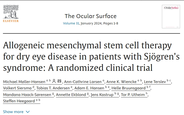 異基因間充質干細胞治療干燥綜合征患者干眼癥：一項隨機臨床試驗