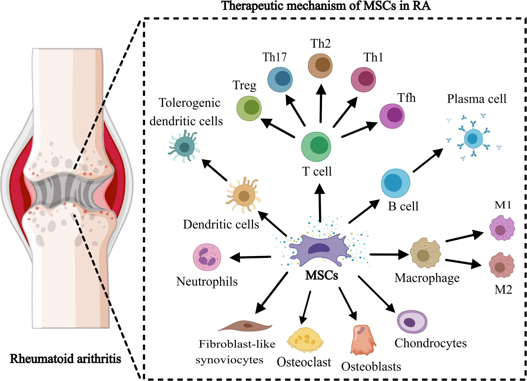 間充質(zhì)干細(xì)胞治療類風(fēng)濕性關(guān)節(jié)炎中的作用機(jī)制